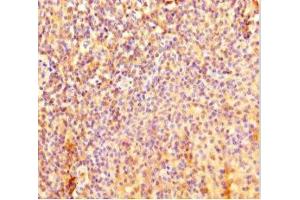 Immunohistochemistry of paraffin-embedded human tonsil tissue using ABIN7157778 at dilution of 1:100 (IL4I1 抗体  (AA 139-339))