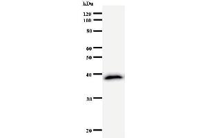 Western Blotting (WB) image for anti-CSRP2 Binding Protein (CSRP2BP) antibody (ABIN931052)