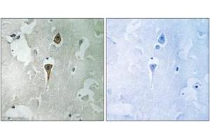 Immunohistochemistry analysis of paraffin-embedded human brain tissue, using NMDAR1 (Ab-890) Antibody.