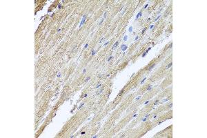 Immunohistochemistry of paraffin-embedded rat heart using PIK3C2A antibody at dilution of 1:100 (x40 lens). (PIK3C2A 抗体)