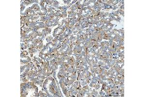 IHC analysis of ACE using anti-ACE antibody (ABIN3043777). (Angiotensin I Converting Enzyme 1 抗体  (AA 651-864))