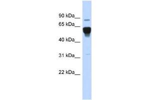 WB Suggested Anti-NR4A2 Antibody Titration:  0. (NR4A2 抗体  (Middle Region))