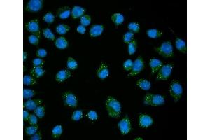 IF analysis of EDC4 using anti-EDC4 antibody (ABIN7599694).