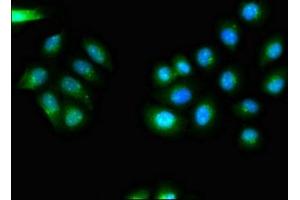 Immunofluorescent analysis of A549 cells using ABIN7147230 at dilution of 1:100 and Alexa Fluor 488-congugated AffiniPure Goat Anti-Rabbit IgG(H+L)