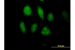 Immunofluorescence of purified MaxPab antibody to MLKL on HeLa cell. (MLKL 抗体  (AA 1-471))