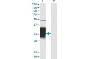 Western Blot analysis of ZNF428 expression in transfected 293T cell line by ZNF428 monoclonal antibody (M01), clone 3H4. (ZNF428 抗体  (AA 1-188))