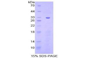 SDS-PAGE (SDS) image for Checkpoint Kinase 1 (CHEK1) (AA 194-446) protein (His tag) (ABIN1879657) (CHEK1 Protein (AA 194-446) (His tag))