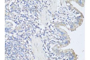 Immunohistochemistry of paraffin-embedded rat lung using CASP3 antibody (ABIN6292881) at dilution of 1:100 (40x lens). (Caspase 3 抗体)