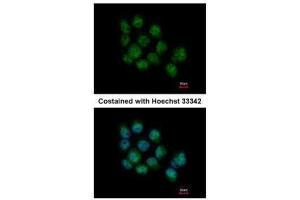 ICC/IF Image Immunofluorescence analysis of paraformaldehyde-fixed A431, using DDX5, antibody at 1:500 dilution. (DDX5 抗体  (C-Term))