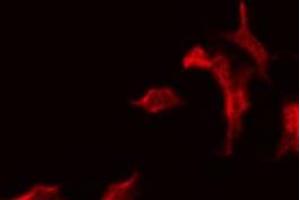 Immunofluorescence (fixed cells) (IF/ICC) image for anti-Solute Carrier Family 5 (Sodium/glucose Cotransporter), Member 2 (SLC5A2) (N-Term) antibody (ABIN6258324)