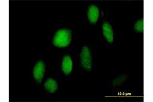 Immunofluorescence of purified MaxPab antibody to ZNF473 on HeLa cell.