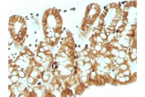 IHC testing of FFPE mouse colon tissue with EpCAM antibody.