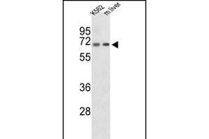 Western blot analysis of CROT Antibody (N-term) (ABIN653328 and ABIN2842818) in K562 cell line and mouse liver tissue lysates (35 μg/lane). (CROT 抗体  (N-Term))
