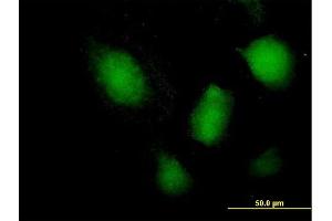 Immunofluorescence (IF) image for anti-Nuclear Factor of Activated T-Cells, Cytoplasmic, Calcineurin-Dependent 3 (NFATC3) (AA 1-1068) antibody (ABIN518311)