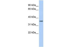 WB Suggested Anti-PDHB Antibody Titration:  0. (PDHB 抗体  (N-Term))