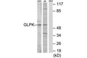 Western blot analysis of extracts from 293/Jurkat cells, using GK Antibody. (Glycerol Kinase 抗体  (AA 461-510))