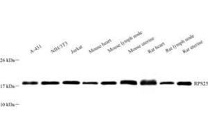 Western blot analysis of RPS25 (ABIN7075449)at dilution of 1: 1000 (RPS25 抗体)