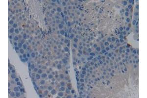 DAB staining on IHC-P; Samples: Mouse Testis Tissue (Caspase 9 抗体  (AA 1-200))