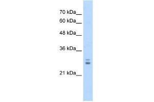 WB Suggested Anti-KCTD11 Antibody Titration:  1.