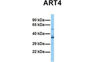 Host:  Rabbit  Target Name:  ART4  Sample Tissue:  Human Stomach Tumor  Antibody Dilution:  1. (ART4 抗体  (Middle Region))