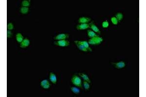 Immunofluorescent analysis of HepG2 cells using ABIN7173051 at dilution of 1:100 and Alexa Fluor 488-congugated AffiniPure Goat Anti-Rabbit IgG(H+L) (TMEM139 抗体  (AA 56-216))