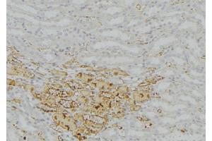 ABIN6277758 at 1/100 staining Mouse kidney tissue by IHC-P. (Catalase 抗体)