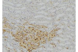 ABIN6277758 at 1/100 staining Mouse kidney tissue by IHC-P. (Catalase 抗体)