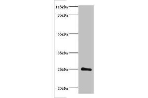 Western blot All lanes: Protein DGCR6L antibody at 2 μg/mL + Mouse brain tissue Secondary Goat polyclonal to rabbit IgG at 1/10000 dilution Predicted band size: 25 kDa Observed band size: 25 kDa (DGCR6L 抗体  (AA 1-220))
