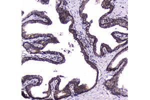 IHC analysis of WWOX using anti-WWOX antibody . (WWOX 抗体  (AA 1-245))