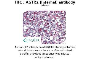 Image no. 1 for anti-Angiotensin II Receptor, Type 2 (AGTR2) (Internal Region) antibody (ABIN1731612) (Angiotensin II Type 2 Receptor 抗体  (Internal Region))