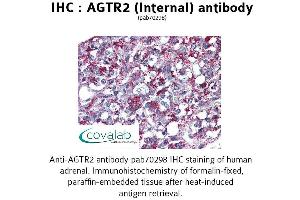 Image no. 1 for anti-Angiotensin II Receptor, Type 2 (AGTR2) (Internal Region) antibody (ABIN1731612)