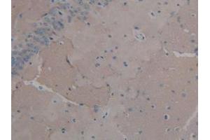 Detection of FGF2 in Mouse Brain Tissue using Polyclonal Antibody to Fibroblast Growth Factor 2, Basic (FGF2) (FGF2 抗体  (AA 10-154))
