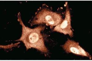 Immunofluorescence staining of human endothelial cells. (TIAL1 抗体  (AA 161-365))