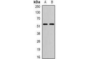 Western blot analysis of ATG13 expression in T47D (A), SW480 (B) whole cell lysates.