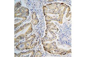 IHC analysis of BRG1 using anti-BRG1 antibody (ABIN7602029).