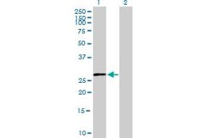 Western Blot analysis of HSD11B1 expression in transfected 293T cell line by HSD11B1 MaxPab polyclonal antibody. (HSD11B1 抗体  (AA 1-292))