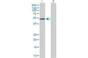 Western Blot analysis of TYMP expression in transfected 293T cell line by TYMP MaxPab polyclonal antibody. (Thymidine Phosphorylase 抗体  (AA 1-482))