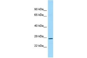 WB Suggested Anti-REP15 Antibody Titration: 1. (REP15 抗体  (N-Term))
