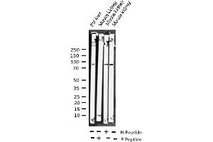 Western blot analysis of Phospho-AhR (Ser36) expression in various lysates (Aryl Hydrocarbon Receptor 抗体  (pSer36))
