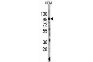 Western blot analysis of anti-PIK3CG Antibody  (R) in CEM cell line lysates (35 μg/lane). (PIK3 gamma 抗体  (AA 1079-1102))