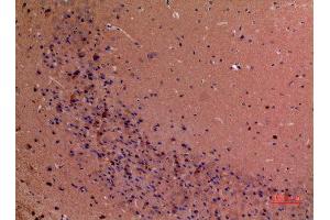 Immunohistochemistry (IHC) image for anti-GDP Dissociation Inhibitor 2 (GDI2) (C-Term) antibody (ABIN3187833)