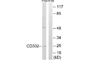 Immunohistochemistry analysis of paraffin-embedded human lymph node tissue using CD302 antibody. (DCL1 抗体)