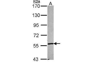 Western Blotting (WB) image for anti-Cytochrome P450, Family 2, Subfamily A, Polypeptide 6 (CYP2A6) (Internal Region) antibody (ABIN2855614)