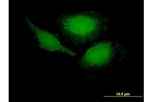 Immunofluorescence of purified MaxPab antibody to PHLDA1 on HeLa cell. (PHLDA1 抗体  (AA 1-259))