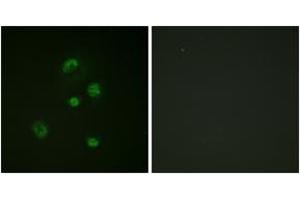 Immunofluorescence analysis of A549 cells, using CHOP (Phospho-Ser30) Antibody. (DDIT3 抗体  (pSer30))