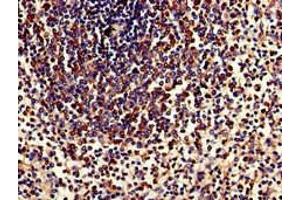Immunohistochemistry of paraffin-embedded human spleen tissue using ABIN7173913 at dilution of 1:100 (TPD52L2 抗体  (AA 1-206))