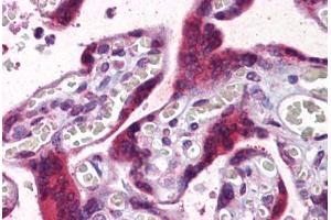 Human Placenta: Formalin-Fixed, Paraffin-Embedded (FFPE) (PGRMC2 抗体  (AA 124-224))