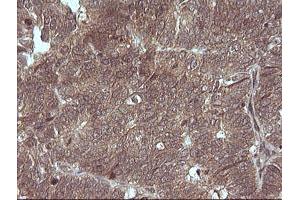 Image no. 2 for anti-Mitogen-Activated Protein Kinase Kinase 3 (MAP2K3) antibody (ABIN1499406)