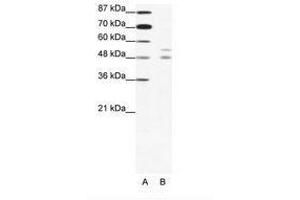 Image no. 1 for anti-Microphthalmia-Associated Transcription Factor (MITF) (N-Term) antibody (ABIN203124) (MITF 抗体  (N-Term))