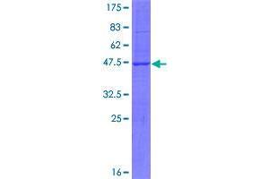 SBNO1 Protein (AA 1-181) (GST tag)